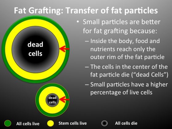 An illustrating showing the reasons why small particles are better for fat grafting.